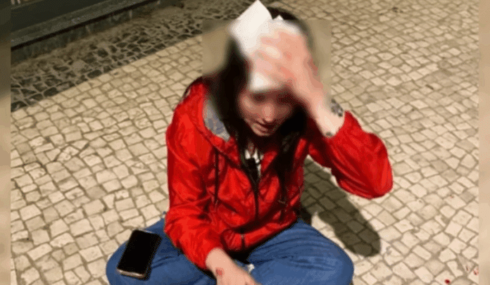 Brasileira é atacada com pedrada no Porto