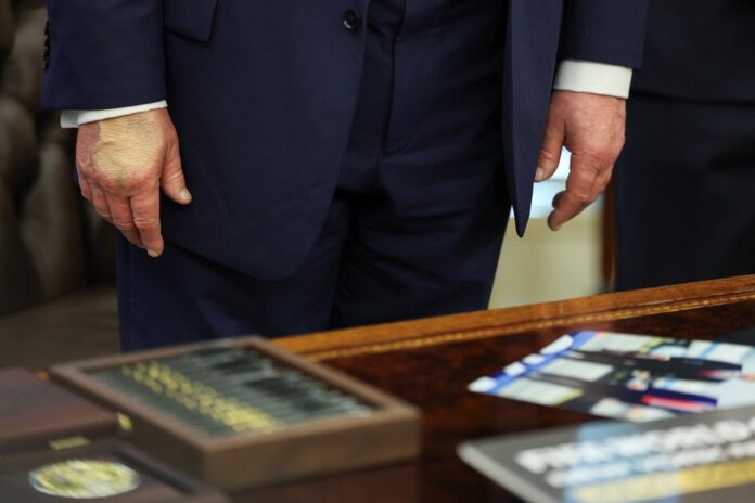 Trump aparece com mão maquiada